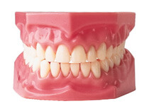 Dentures model 