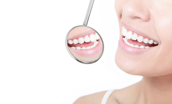 Teeth Whitening and Dental Braces